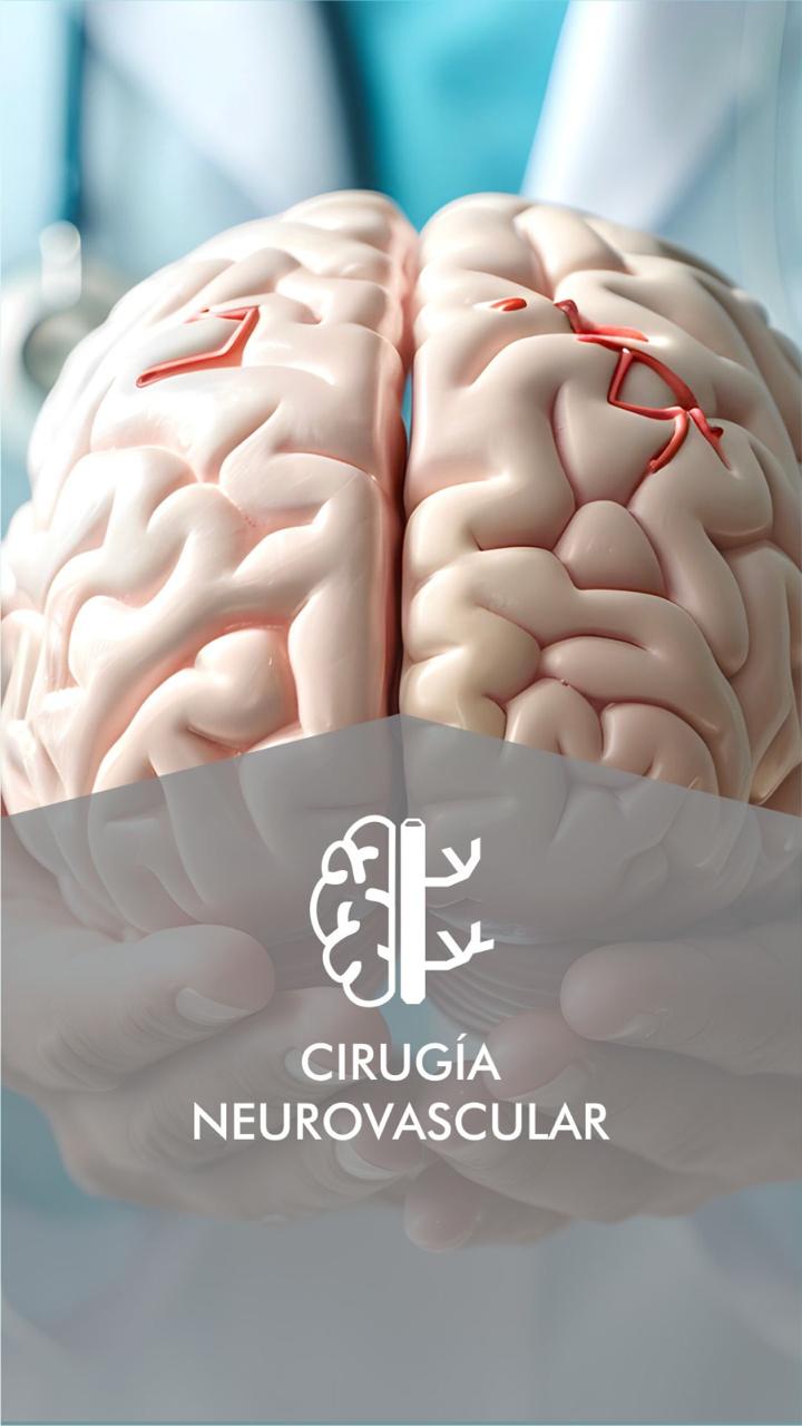 Cirugía Neurovascular